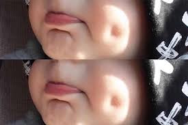چال گونه